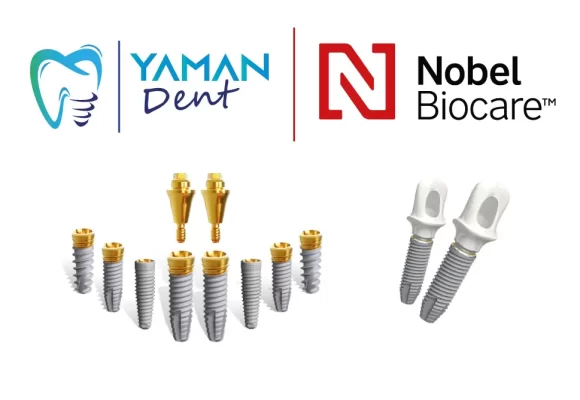 Nobel implants