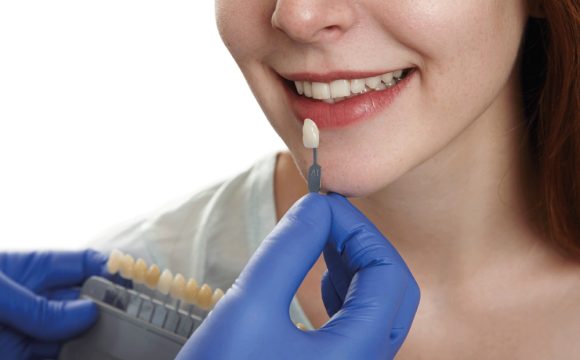 Dental Implants vs. Veneers: What is the Difference?