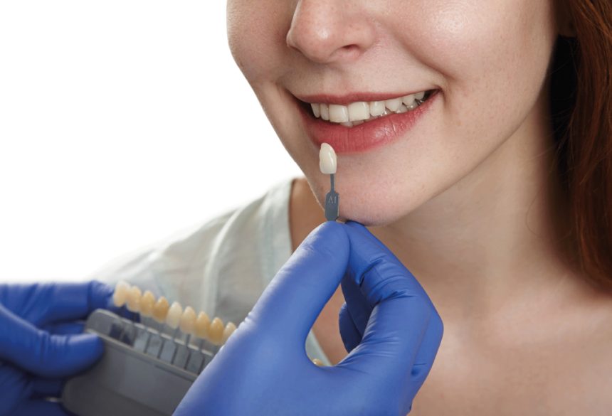 Dental Implants vs. Veneers: What is the Difference?